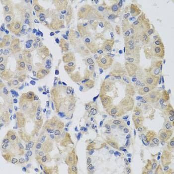 Anti-GPT Antibody