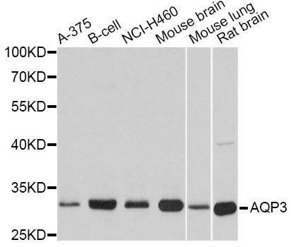 Anti-AQP3 Antibody