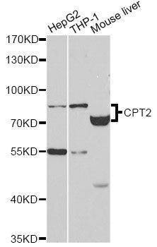 Anti-CPT2 Antibody
