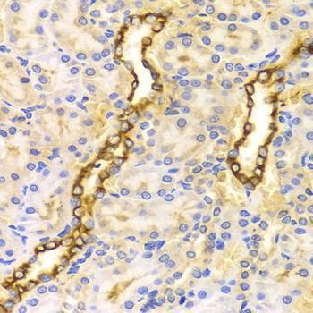 Anti-CPT2 Antibody