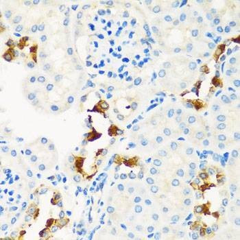 Anti-CPT2 Antibody