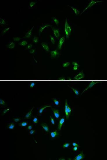Anti-CPT2 Antibody