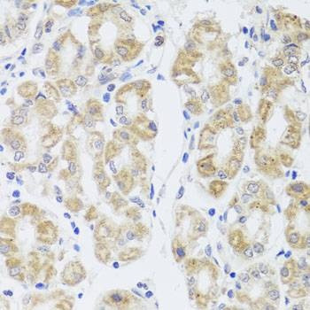 Anti-MIP Antibody