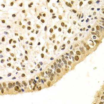 Anti-DDB1 Antibody