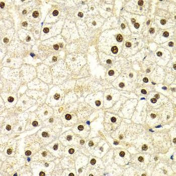 Anti-DDB1 Antibody