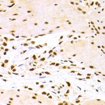 Anti-DDB1 Antibody