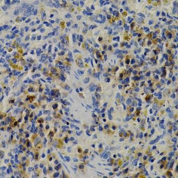 Anti-DNMT3B Antibody