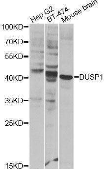 Anti-DUSP1 Antibody