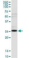 Anti-CLTA Antibody