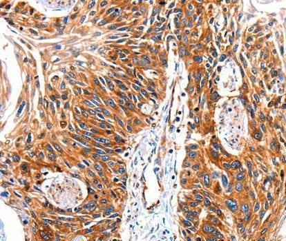 Anti-GRK1 Antibody