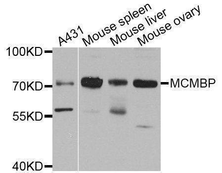 Anti-MCMBP Antibody