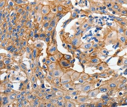 Anti-CDH1 Antibody