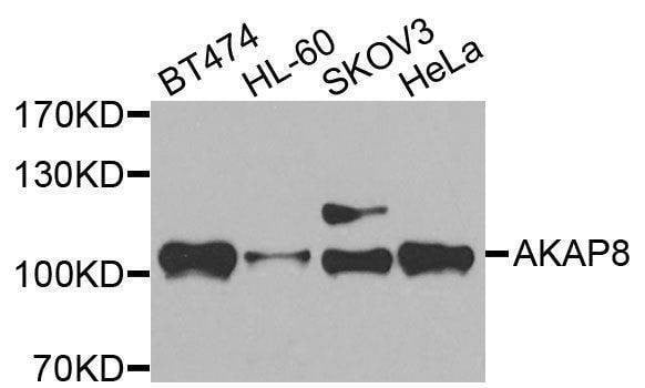 Anti-AKAP8 Antibody