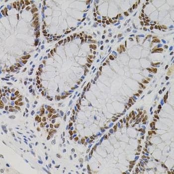 Anti-AKAP8 Antibody