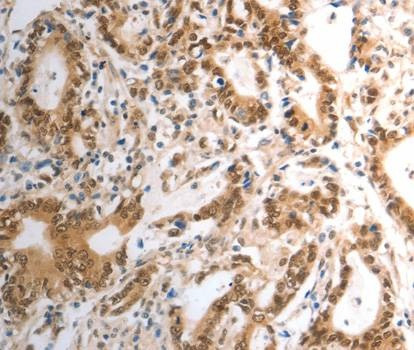 Anti-RAD50 Antibody