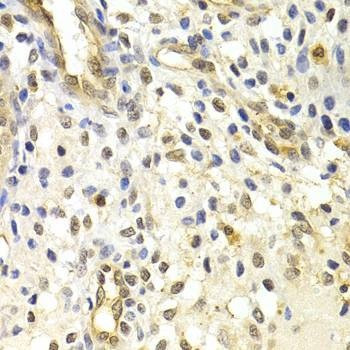Anti-RAD50 Antibody
