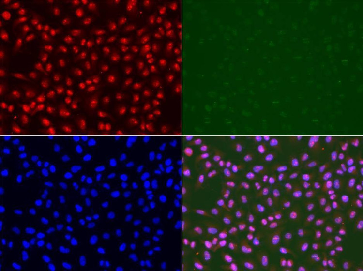 Anti-RAD50 Antibody