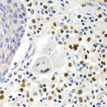 Anti-GEMIN2 Antibody