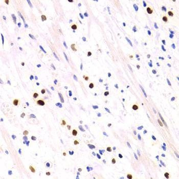 Anti-GEMIN2 Antibody