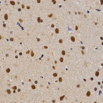 Anti-PELP1 Antibody