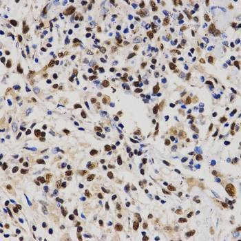 Anti-PELP1 Antibody