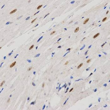 Anti-PELP1 Antibody