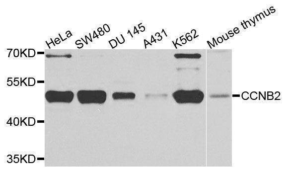Anti-CCNB2 Antibody