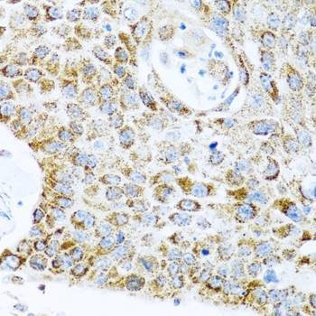 Anti-LRPPRC Antibody