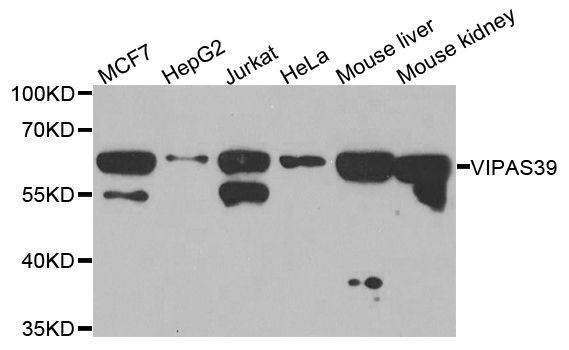 Anti-VIPAS39 Antibody