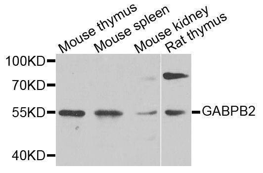 Anti-Mouse/Rat GABPB2 Antibody