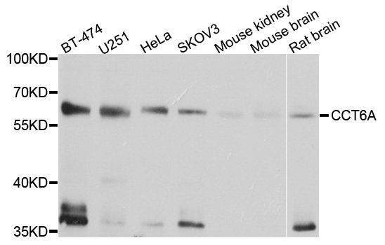 Anti-CCT6A Antibody