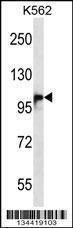 Anti-DSG1 (Center) Antibody