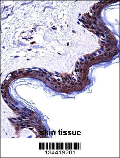 Anti-DSG1 (Center) Antibody