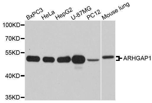 Anti-ARHGAP1 Antibody