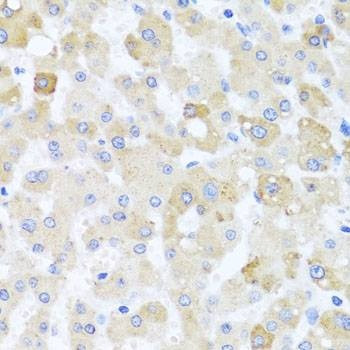 Anti-CETN1 Antibody