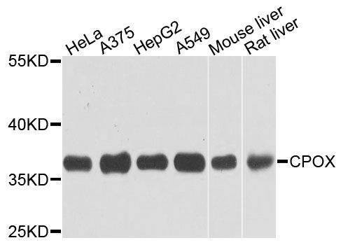Anti-CPOX Antibody
