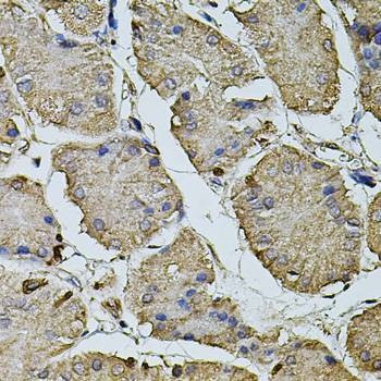 Anti-CPOX Antibody