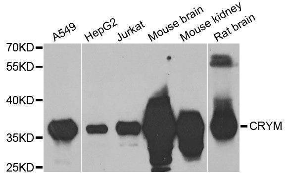 Anti-CRYM Antibody