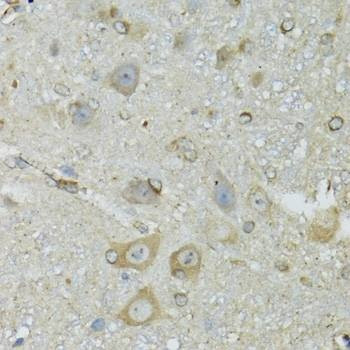 Anti-CRYM Antibody