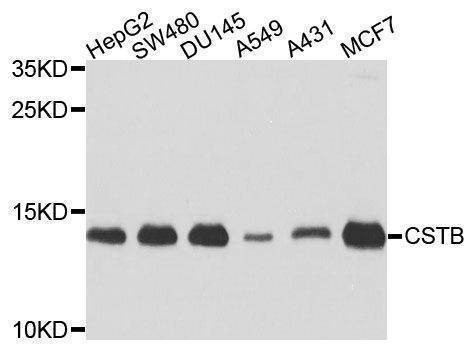 Anti-CSTB Antibody