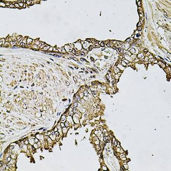 Anti-CSTB Antibody