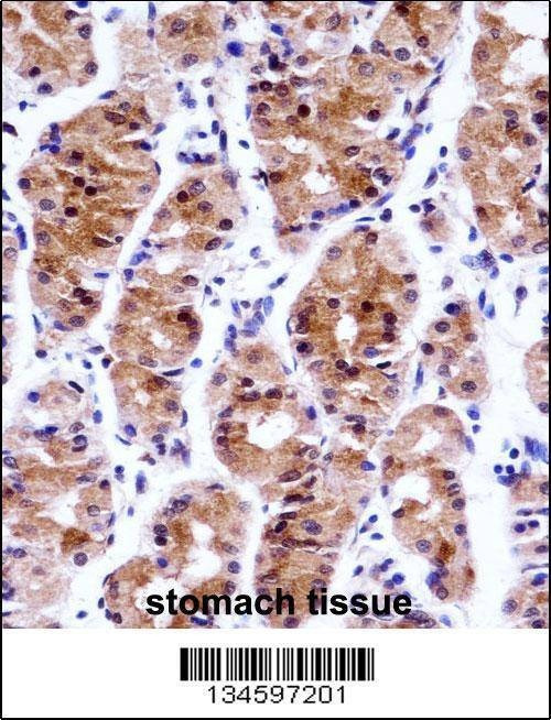 Anti-GTF2E1 (N-term) Antibody