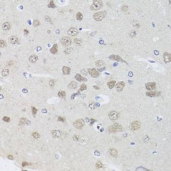 Anti-PPP1CC Antibody