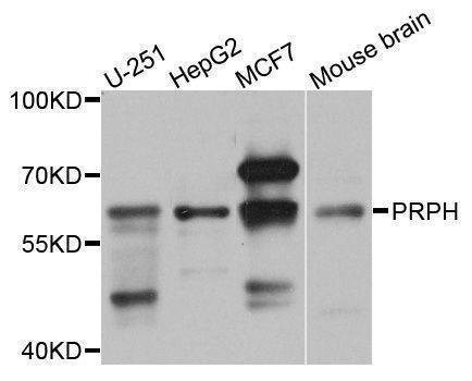 Anti-PRPH Antibody