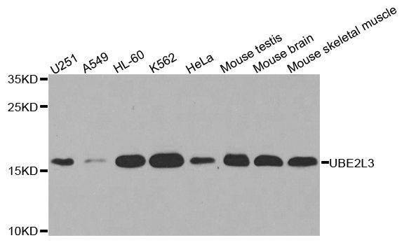 Anti-UBE2L3 Antibody