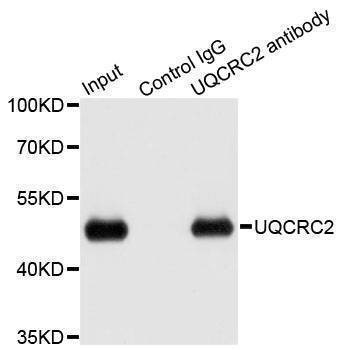 Anti-UQCRC2 Antibody
