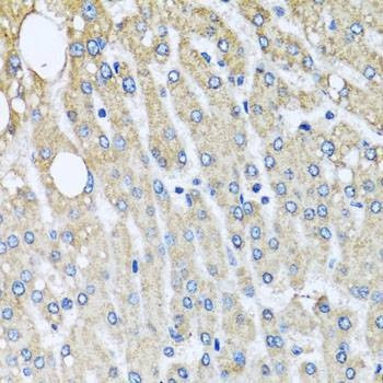 Anti-UQCRC2 Antibody