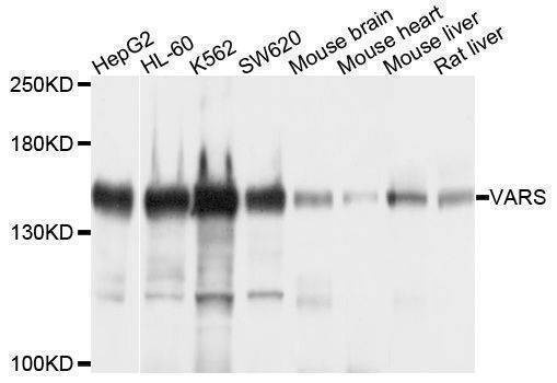 Anti-VARS Antibody