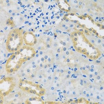 Anti-PMPCB Antibody