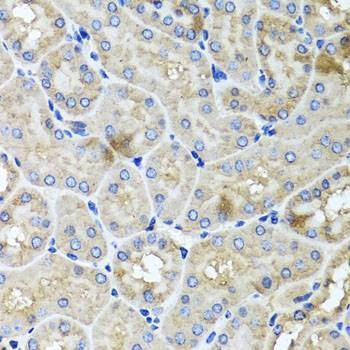 Anti-USH1C Antibody